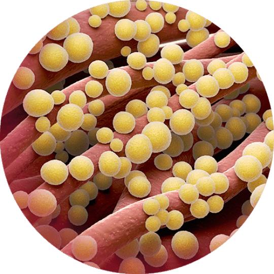 Staphylococcus aureus