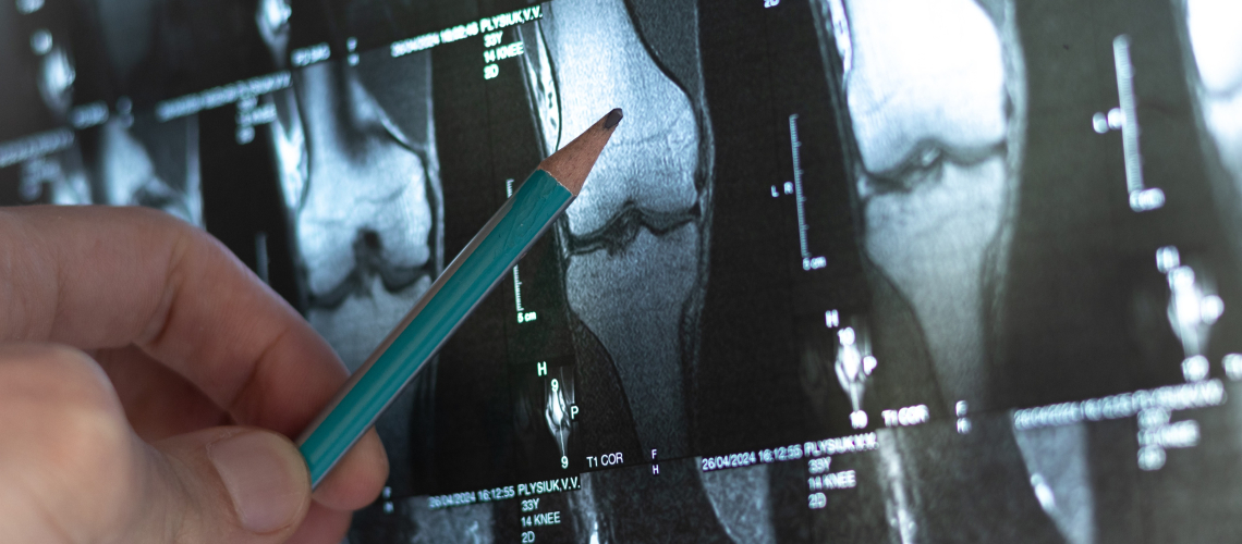 Дирижеры остеогенеза