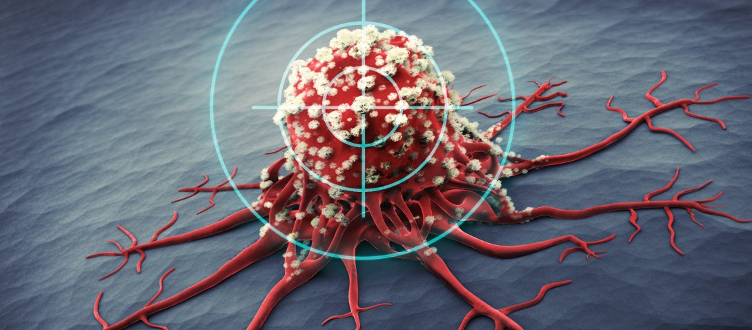 И пусть рак не возвращается