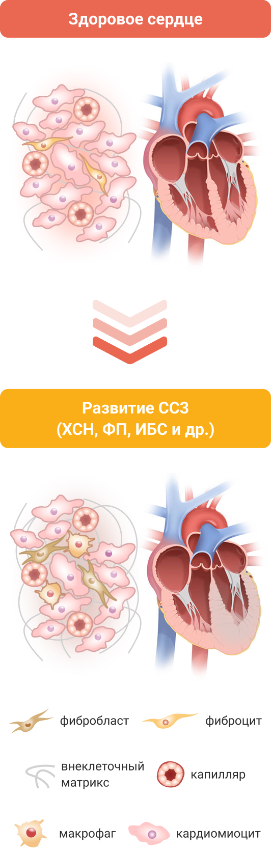 Гиперактивация МКР в сердце
