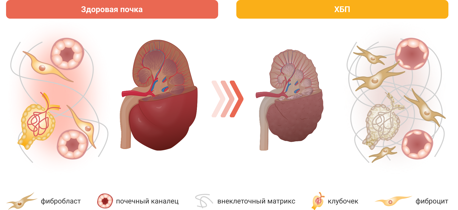Гиперактивация МКР в почках